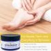 Yellow Bird Natural Soothing Foot & Body Balm - Organic Skin Moisturizer & Itch Relief Cream for Baby Diaper Care | Arnica Chamomile & Copaiba - 4oz - Buy Online on GoSupps.com