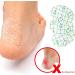 Baby Waterproof Ear Stickers - 40 PCS Disposable Newborn Ear Protectors for Correcting & Protecting, Anti-wear Shoe Stickers for Heel Blisters - Invisible Patch Bandages - Buy Online on GoSupps.com