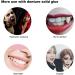 FCcassiel Snap on Veneers - Temporary Teeth Cover for Men and Women - Fix Imperfect Teeth, No Pain or Drilling - Pack of 2 - Buy Online on GoSupps.com
