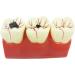 Buy Samnuerly 4-Fold Dental Teeth Caries Model - Removable Tooth Pathology & Evolutionary Display for Dental Training | International Shipping Available - Buy Online on GoSupps.com