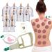 Cupping Set with Pump 12 Cups Cupping Therapy Set Vacuum Suction Cups Massager for Cellulite Reduction Back Neck Joint Pain Relief,Chinese Hijama Cupping Set