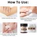 Dark Knees Elbows Knuckles Corrector Cream Skin Cleaning Bleaching Cream for Elbows Knees Armpit Underarm Inner thighs Intimate Areas Dark Spot (120g/4.2oz) - Buy Online on GoSupps.com