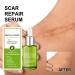 BOKIOESDE Women Hip Chest Stretch Mark Serum Body Burn Scars Serum Girls Skin Care Repair Essence Beauty Supplies - Buy Online on GoSupps.com