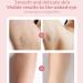 Lumisylk Pro Facial Epilator Waterproof and Painless Rechargeable Epilator Epilator for Face Arms Legs and Armpits 2 Pcs - Buy Online on GoSupps.com