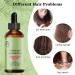 Fengyang Rosemary Oil for Hair Growth | Pure Rosemary Essential Oil for Thicker Hair - Buy Online on GoSupps.com