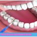 Interdental Gum Brushes - 360 Angled Soft Bristles | Tight Tooth Cleaning Tools - Floss Cleaner 2 Sizes for Effective Oral Care - Buy Online on GoSupps.com