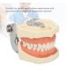 Upper Jaw Cyst Dental Model - Soft Gum 28 Teeth Practice Frame for Abscessing (International Shipping) - Buy Online on GoSupps.com