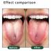 Silicone Tongue Scraper | Bad Breath Fighter | Travel-Friendly Oral Care for Adults | Easy to Use Pink Tongue Cleaner - Buy Online on GoSupps.com
