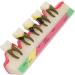 Shop Verdant Touch Tooth Model - Dental Periodontal Disease Study Tool for Schools | International Shipping Available - Buy Online on GoSupps.com