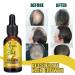 Enkomy Hair Growth Serum | 40ml Anti-Hair Loss Ginger Oil - Boost Hair Growth & Nourishment - Buy Online on GoSupps.com