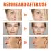 3pcs Botox Stock Solution Facial Serum - 2023 Newest Anti-Wrinkle & Anti-Aging Treatment endorsed by Jennifer Aniston - Buy Online on GoSupps.com