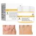 Soothing and Repairing Cream | 50ml Natural Skin Moisturizer Itch Relief Cream for Dry Skin Redness and Itching Soothing and Nourishing and