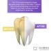 V34 Purple Toothpaste - Whiten Teeth & Remove Stains | 2 x 60ml Color Correction Tooth Color Corrector - Buy Online on GoSupps.com