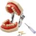 Shop Bovdc Teeth Model - Complete Dental Learning Tool for Tooth Extraction & Patient Communication - Buy Online on GoSupps.com