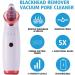 VWMYQ Electric Blackhead Remover Vacuum - Pore Cleaner Tool with 5 Suction Heads (White) - Buy Online on GoSupps.com