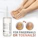 7 Days Nail Growth and Strengthening Serum Natural Nail Growth And Strength Serum Nail Repair Solution for Damaged and Discolored Nails Promotes Rapid Growth & Avoids Flaking (1pcs) - Buy Online on GoSupps.com