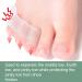 Welnove 8Pcs Gel Pinky Toe Separator - Pain Relief for Curled Pinky Toes and Overlapping Toe Blisters - Buy Online on GoSupps.com