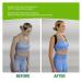 YUYTE Back Posture Corrector Brace | Hunchback Prevention & Pain Relief | Adjustable 8-Shaped Straps for Better Posture - Buy Online on GoSupps.com