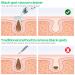 2023 Newest Blackhead Remover Pore Vacuum - Upgraded Electric Facial Cleaner for Acne, Whiteheads - 5 Suction Power, 5 Probes - USB Rechargeable Kit for Women & Men - Buy Online on GoSupps.com