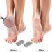 Buy Cuhza Double-Sided Pumice Stones - Effective Foot Care for Hard Skin | 2 Pack Pedicure Stones for Smoothing & Peeling - White Gray - Buy Online on GoSupps.com