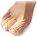Silicone Toe Protector for Hallux Valgus and Bunion Care - Toe Separator and Corrector Sleeve - Buy Online on GoSupps.com