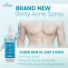 Body Acne Spray with 2% Salicylic Acid, Tea Tree Oil & Centella Asiatica Extract - Non-Drying Treatment for Breakouts on Back, Arms & Chest - 4 fl oz - Buy Online on GoSupps.com
