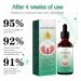 2 PCs Gum Regrowth Drops 30ml | Natural Oral Care Gel for Gum Restoration & Repair | Taper Back Gums Easily - Buy Online on GoSupps.com