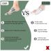 Upgraded Bunion Fixator | Adjustable Voltage Toe Splitter for Day & Night Use | Effective Bunion Treatment - Buy Online on GoSupps.com