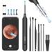 Ear Wax Removal Tool  Ear Cleaner with 1080P HD Camera  Otoscope with Light  Ear Cleaning Kit with 7 Pcs Ear Set  Earwax Removal Kit with 6 LED Lights  Ear Camera for iPhone  iPad  Android Phones