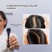 DermaRoller Hair | Hair Growth Roller | 540 Titanium Microneedles | Trichological Quality | Fights Hair Loss | Regenerates the Scalp | MakeMyMask - Buy Online on GoSupps.com