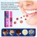 Spray Haleine Fraiche Spray Buccal Vaporisateur D'Halitose D'Odeur Orale limine les Mauvaises Odeurs et Combat la S cheresse Buccale Haleine Fra Che Fruit E Confort Buccal 20ML - Buy Online on GoSupps.com