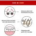 JAYU PET Black Seed Brush - Cat Acne Chin Treatment Cat Acne Brush Silicone Brush for Cats Chin Acne & Blackhead Exfoliation Double-sided Cat Grooming Brush (1PCS) - Buy Online on GoSupps.com