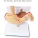 Educational Model Simulated Human Stomach Anatomy Model Diseased Stomach Model Stomach Disease Demonstration Model Pathological Stomach Model Medical Models - Buy Online on GoSupps.com