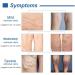 Varicose & Spider Veins Cream for Legs - Improve Blood Circulation, Varicose Care Ointment (50g) - Buy Online on GoSupps.com