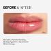VT COSMETICS VT Reedle S Lip Plumper Expert Brillant l vres transparent 4 3 g sans parfum hydratant cosm tique cor enne - Buy Online on GoSupps.com