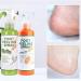 Anushka Foot Peeling Spray Oil | Quick Dead Skin Removal & Hydrating Exfoliation | Effective Callus Treatment - Buy Online on GoSupps.com