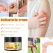 Natural Chinese Herb Eczema Psoriasis Cream for Dry & Itchy Skin Relief - Anti-Itch Plant-Based Hydration - Fragrance-Free (1 Pack) - Buy Online on GoSupps.com