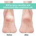 Vaincre Cracked Heel Repair Socks - 4 Pairs for Dry Cracked Feet - Gel Treatment - Spa Moisture - Overnight Heel Care (Regular, Multi-color) - Buy Online on GoSupps.com