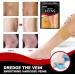 Veinhealth Varicose Veins Treatment Patch - 24PCS Spider Veins Removal for Legs - 24 Count - Buy Online on GoSupps.com