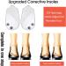 O/X Type Leg Corrector Insoles - 3 Pairs Soft Gel Orthopedic Inserts with Magnet for Foot Alignment & Pain Relief | Knock Knee & Bow Legs Support - Buy Online on GoSupps.com