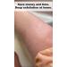 SILK Exfoliating Glove: Deep Exfoliation for Smooth Skin and Keratosis Pilaris Removal - Buy Online on GoSupps.com