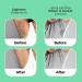 Kojic Acid Underarm Roll-On 50ml - 6% Actives - AHA Niacinamide - Controls Odor & Fades Pigmentation for Men & Women - Buy Online on GoSupps.com