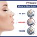 Massner Nasal Strips for Snoring - Large 100 Pack, Extra Strength Anti-Snoring Solution for Men & Women - Improve Breathing, Reduce Snoring - Stuffy Nose Relief - Buy Online on GoSupps.com