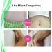 Professional Legs Sticker Artifact Tighten Calf with Natural Ingredients Weight Loss Thin Butterfly Arm - Buy Online on GoSupps.com