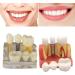 4x Dental Implant Teeth Model with Removable Crown - Crown & Bridge Dentist Training Tool for Patient Analysis | International Shipping - Buy Online on GoSupps.com