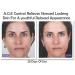 AGE Control Dual Treatment Anti Glycation Serum - Look 8-10 Years Younger in 60 Days | Reduce Dark Spots Lift Firm Brighten & Hydrate | Non-Greasy Anti-Wrinkle Solution - Buy Online on GoSupps.com