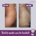 Daily Stretch Mark Treatment Brazilian Cream - Michelle Marques | Deep Hydration Reduces Stretch Marks Enhances Skin Elasticity (150g - Buy Online on GoSupps.com