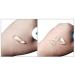 PICKX Organic Scar Removing Gel - Keloid & Surgical Scar Removal Cream - Lightens Scars and Acne Marks - Gentle on Sensitive Skin (1PC) - Buy Online on GoSupps.com