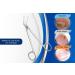 SMI 15.8cm Long Handle Toenail Scissors | Podiatrist Nail Clippers for Seniors | Stainless Steel Nail Cutters for Thick & Ingrown Nails - Buy Online on GoSupps.com