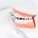 Six-Sided Bristles Toothbrush for Sensitive Teeth & Gums - Gray | Optimal Oral Care for Adults - Buy Online on GoSupps.com